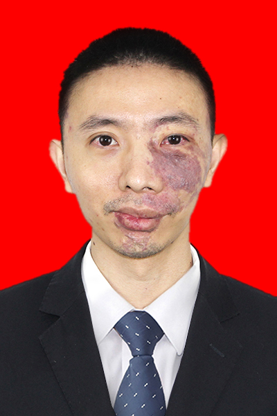 张志平